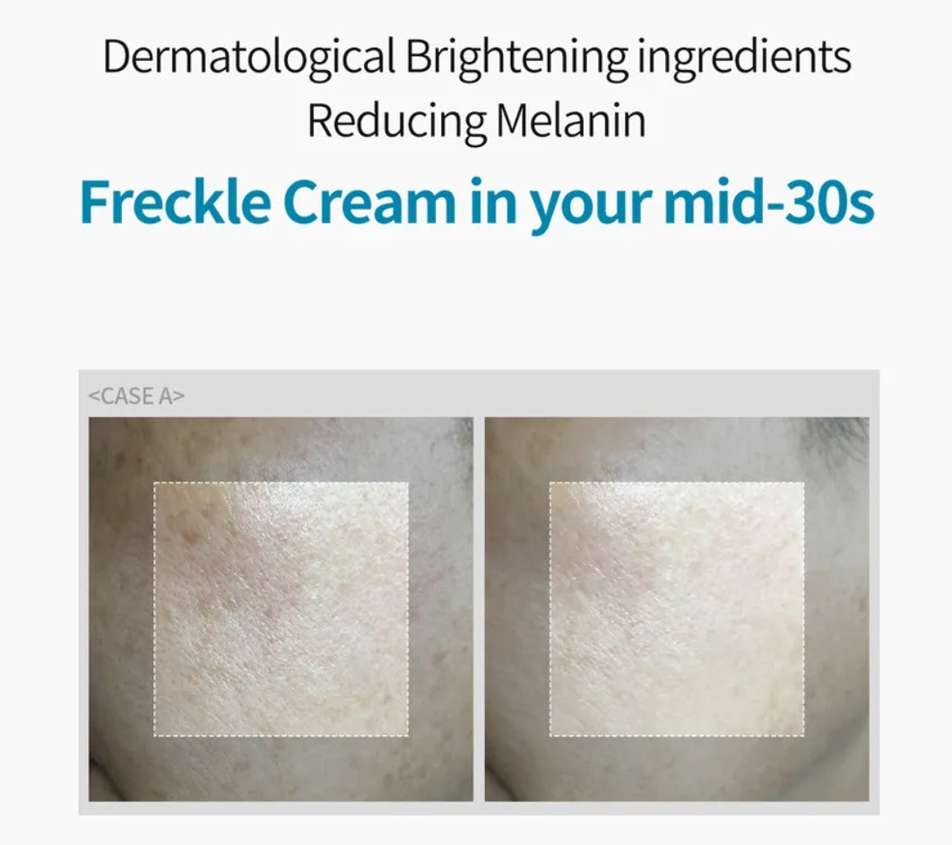 Dr.Melaxin - TX Cream