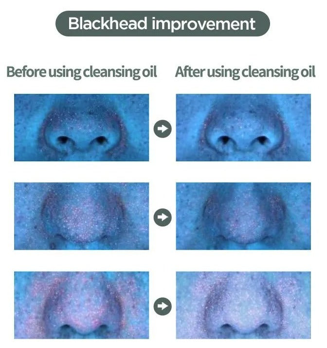 Anua - Heartleaf Pore Control Cleansing Oil